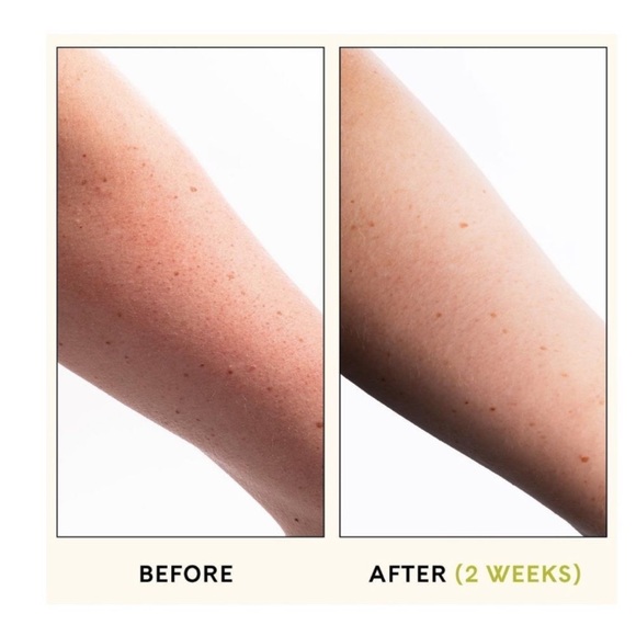 $5 🌸 FUR ~ KP Body Scrub Powerful & Exfoliating ~ NEW - Picture 5 of 10